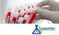 Up to 66% OFF Lab Test at Labotec.